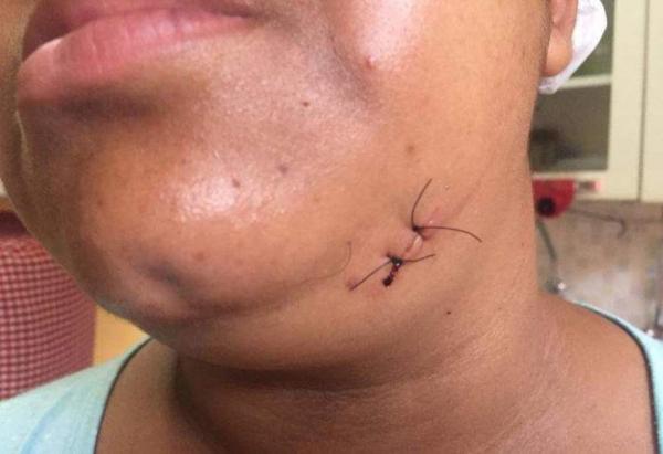 Marido esfaqueia mulher após ser impedido de esquartejar cachorro em Manaus