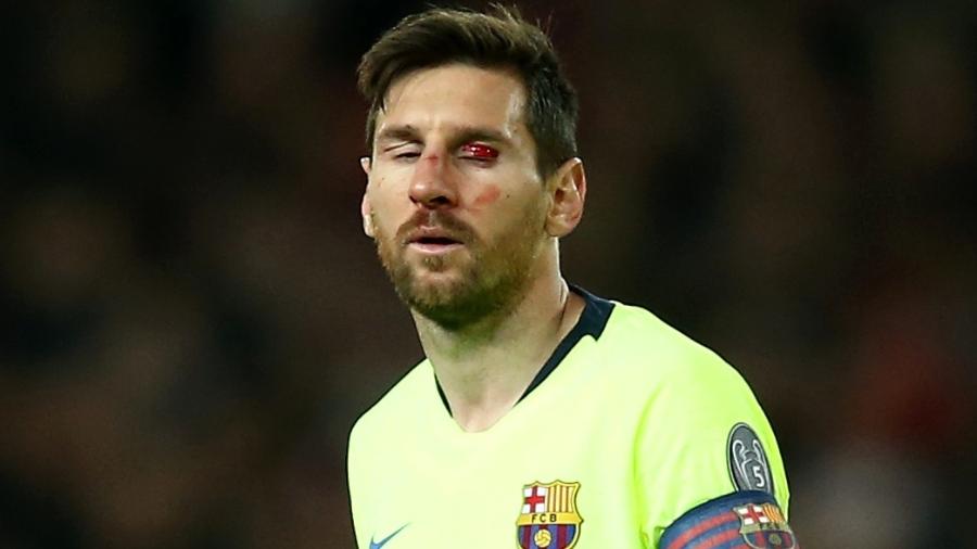 Messi passará por exames após pancada no nariz