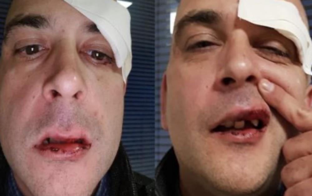 Carregando bolsa da esposa, homem é confundido com gay e apanha