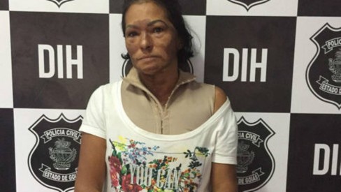 Mulher não aceita fim de relacionamento, ateia fogo no marido e é presa