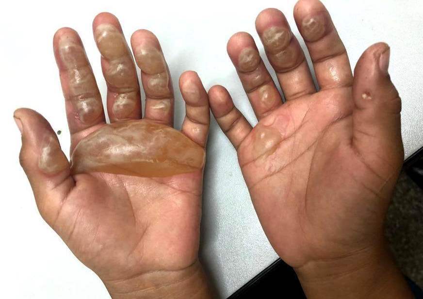 Crimes de tortura contra crianças e adolescentes crescem em Manaus