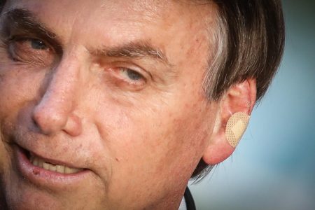 Bolsonaro faz exame para investigar suspeita de câncer de pele