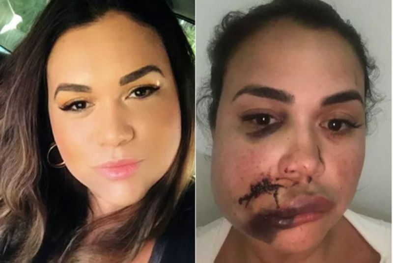 Mulher afirma ter sido agredida dentro de restaurante de luxo