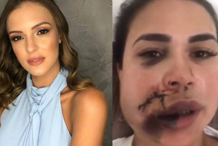 Modelo que agrediu mulher em restaurante no Jockey Club de SP diz estar arrependida