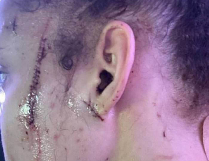 Sobrinha de Michael Jackson sofre ataque racista e é esfaqueada: 'Ninguém merecia isso'