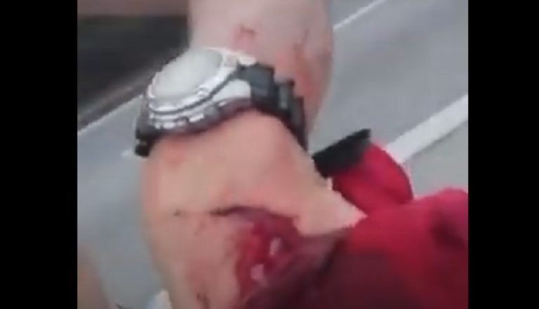 Motociclista cobre o pescoço com a mão para evitar ser degolado