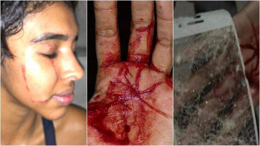 Estudante é agredida e relata injúrias raciais enquanto passeava com cachorro