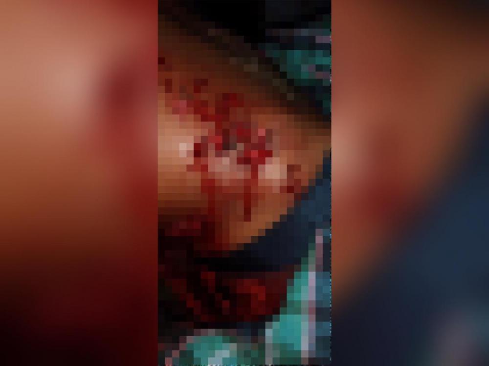 Imagens fortes! Homem recebe tiro no abdômen e motivo impressiona