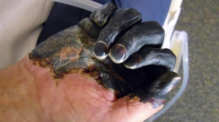 China eleva estado de alerta no país sobre novo caso de peste bubônica