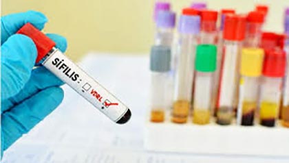 Casos de sífilis voltam a aumentar no Brasil