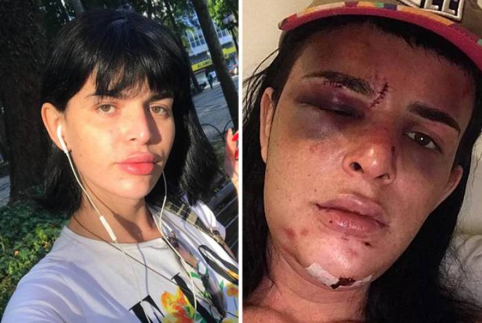 Famosos pedem ajuda para mulher trans que foi agredida dentro de casa