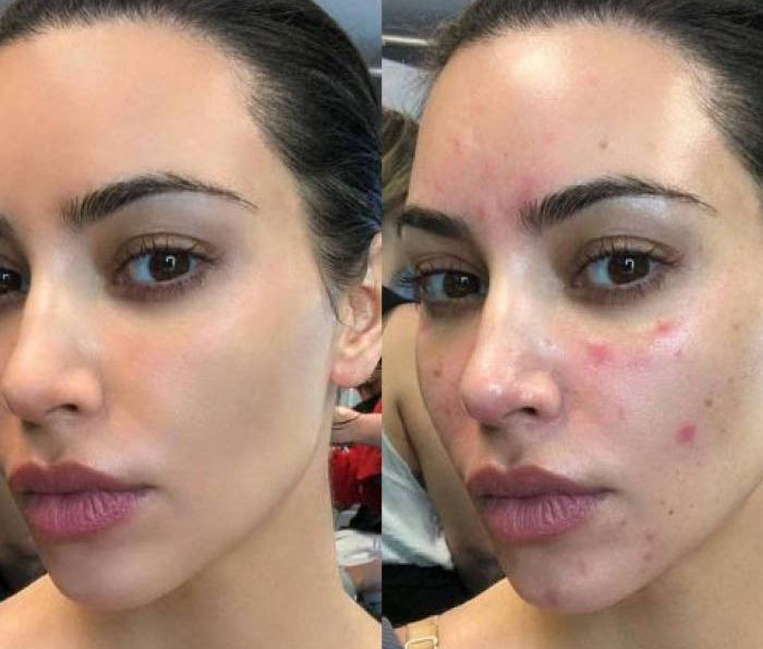 Fotógrafo revela imagens de famosas sem Photoshop e diferença impressiona