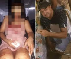 IMAGENS FORTES: Marido valentão espanca e arranca dente da esposa com violento murro na boca