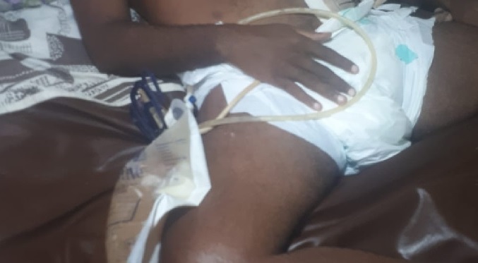 É grave o estado de saúde de PcD estuprado por homem casado em Manaus