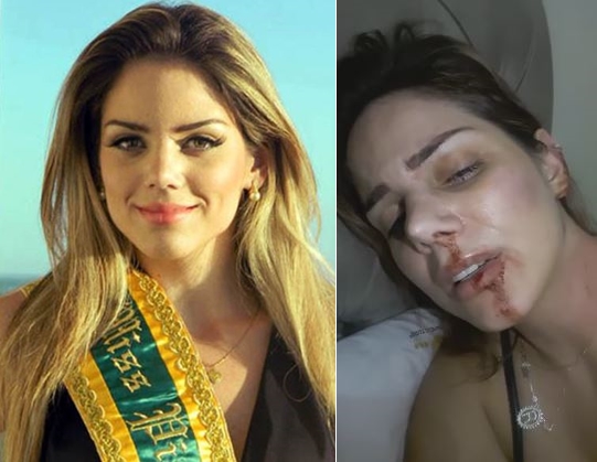 Ex-Miss Piauí presta queixa após agressões: 