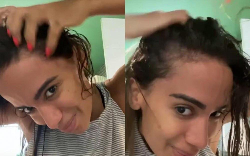 Anitta põe ponto final nos boatos sobre ter raspado a cabeça
