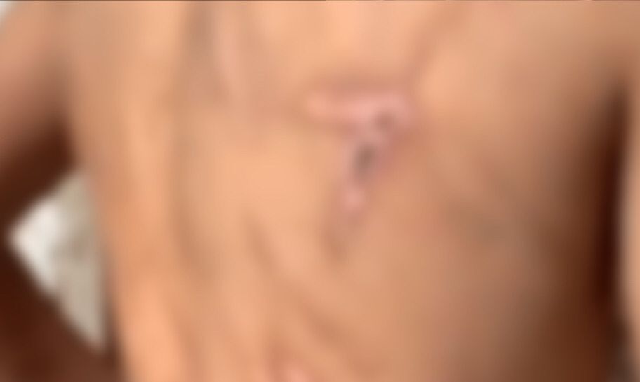 Criança é resgatada após 5 anos sofrendo tortura