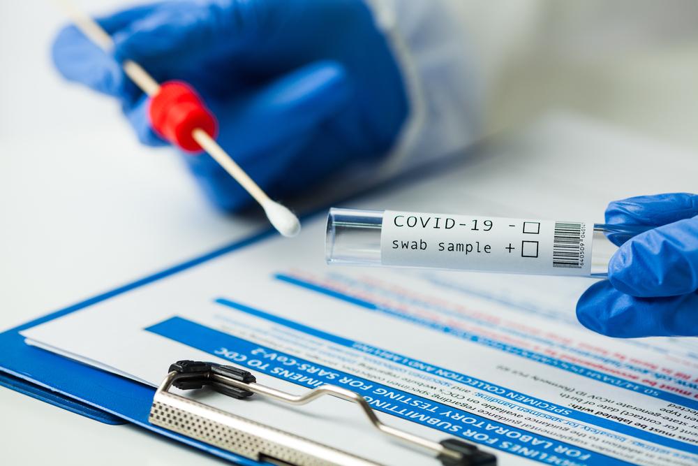 Mais de 130 casos de Covid-19 são registrados no Amazonas nas últimas 24 horas, informa FVS