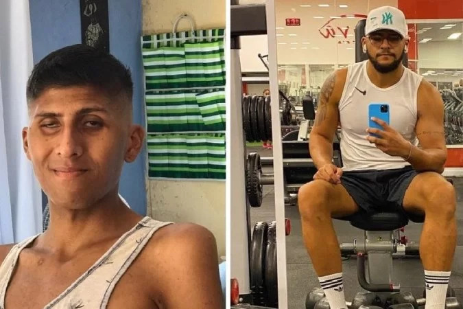 ‘Aids levou minha visão do olho direito e limitou meus movimentos'