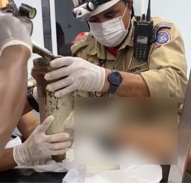 Açougueiro tem mão esmagada em moedor de carne, em Manaus