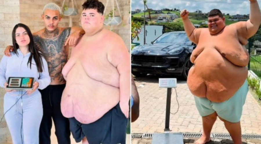 Influenciador Gordão da XJ perde 115 kg e atinge peso para bariátrica