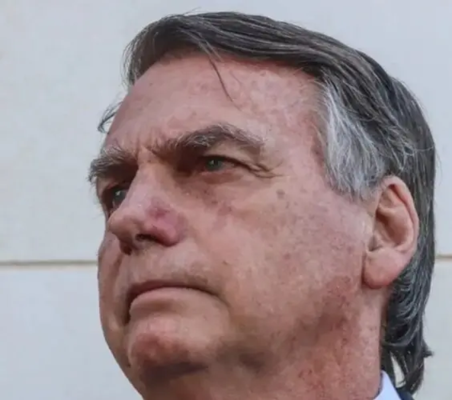 Bolsonaro alega dores de cabeça intensas devido a barulho de gerador na PF