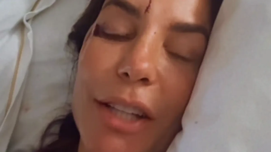 Ivete Sangalo é internada após desmaio em casa