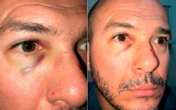 Justiça nega pedido de atendimento médico particular a delegado que matou advogado